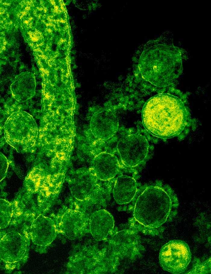 Green-tinted microscopic image of coronavirus particles illustrating viral structures.